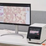 Rapid Response Mobilised as Typhoid Fever Surges Across Oti Region
