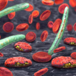 Malaria in Ghana: Current Burden, Response Strategies, and the Road to Elimination